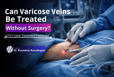 Varicose Vein Treatment Without Surgery: EVLT Explained