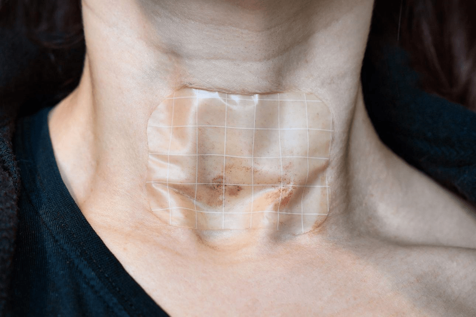 Post Procedure Instructions for Thyroid FNAC with small bandage on neck after biopsy