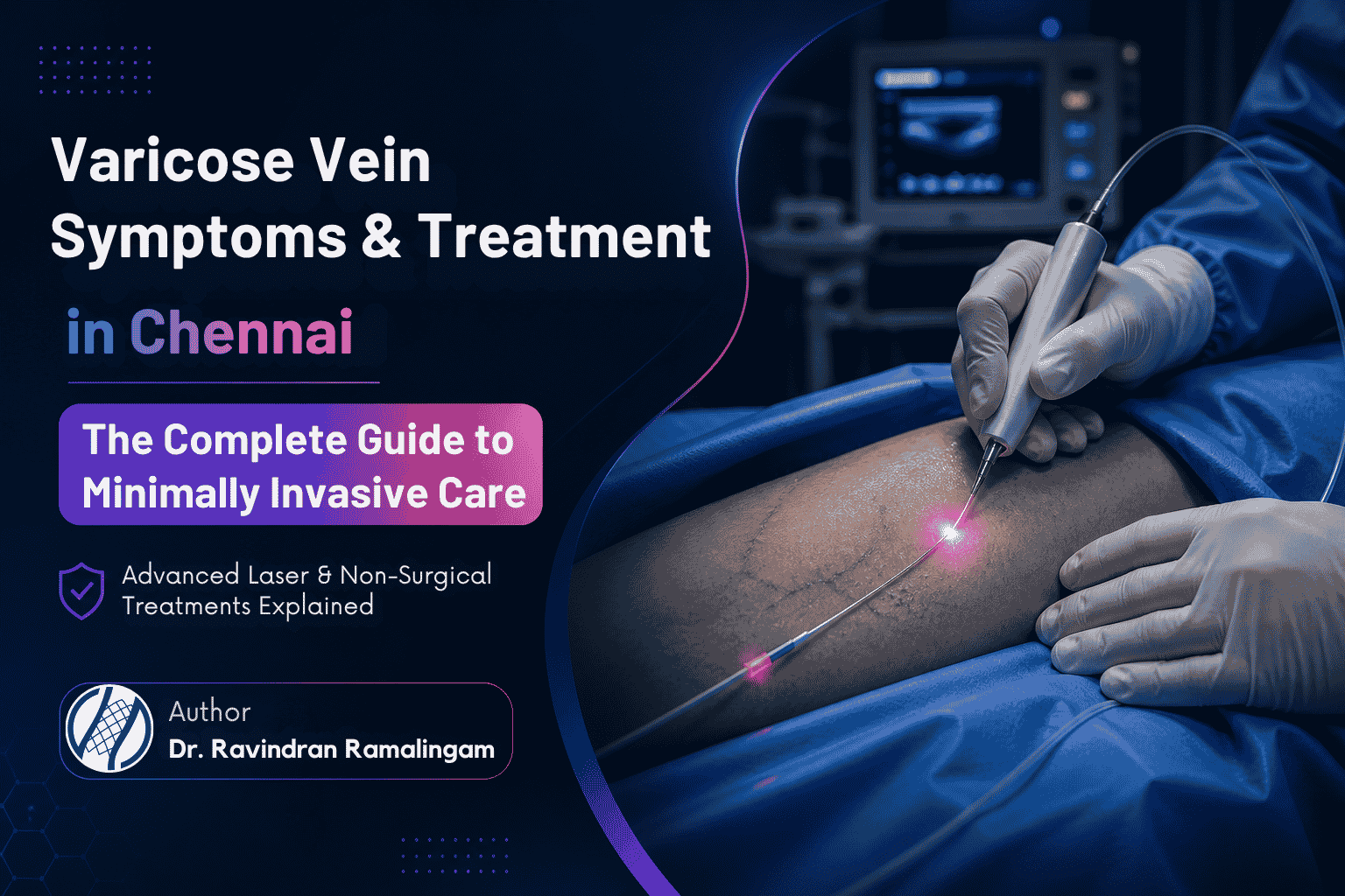 Interventional radiologist treating varicose veins in Chennai