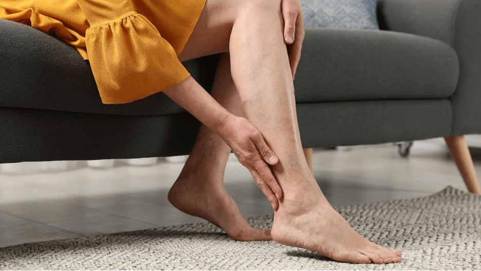 Non-surgical varicose veins treatment Chennai recovery