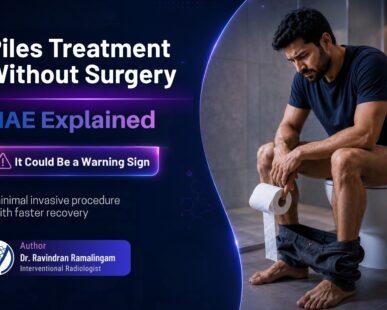 Piles Treatment Without Surgery: Hemorrhoid Artery Embolization Explained