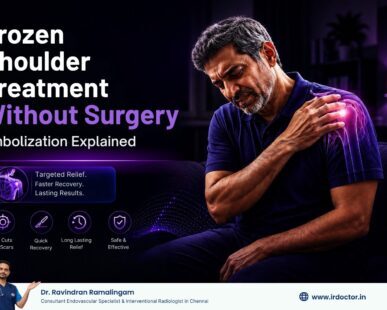 Frozen Shoulder Embolization