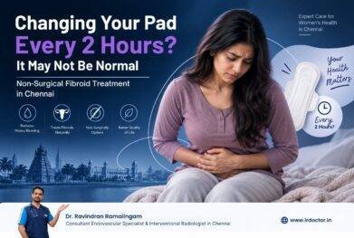 Changing pad every 2 hours due to heavy bleeding from uterine fibroids