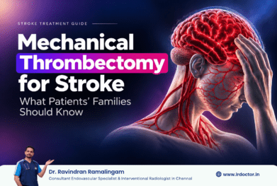Mechanical thrombectomy for stroke: catheter-based clot removal treatment